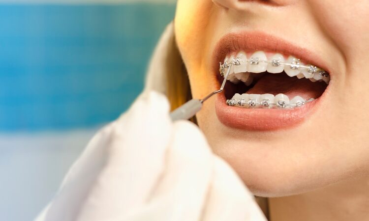 If you’re considering ways to improve your smile, it’s worth taking a closer look at what traditional braces have to offer.
